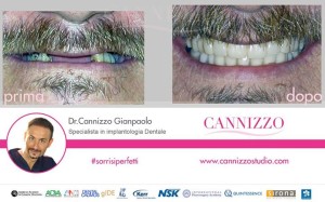 implantologia dentale