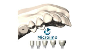 Microimp componenti per impianti