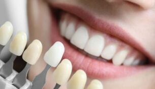 dentista torino