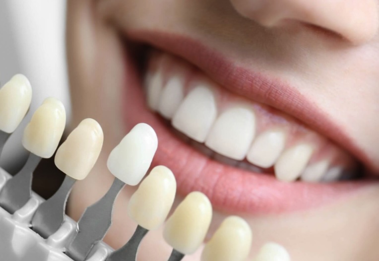 dentista torino